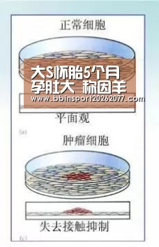 大S怀胎5个月孕肚大 称因羊水多宝宝重-BBIN官网(图1) BBIN登录